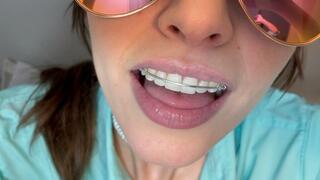 Giantess Vore with Braces