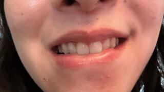 Aurora’s Sexy Teeth Strike Again