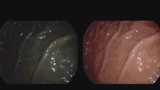 A longer trip, you won´t escape!!!