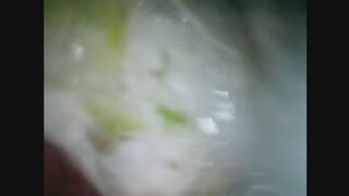 Trinas Toys (STOMACH ENDOSCOPE FOOTAGE)