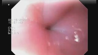 Feeling hungry, can I eat you?