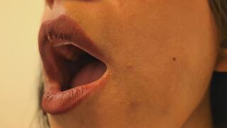 ORAL EXAMINATION: OPEN LIPS OF THE MOUTH | Laura