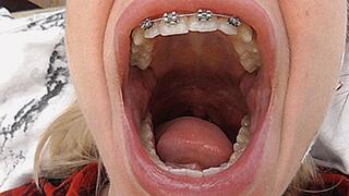 Big wide yawn with a big mouth! MP4