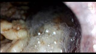 Bailey: Tuna Sandwich Digestion Part 2