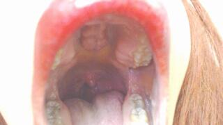 Moving uvula