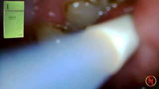 MOND supeslims menthol 100's inside