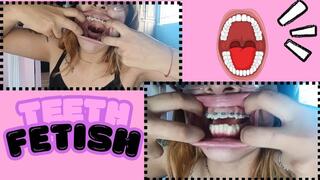 I finally show my big teeth