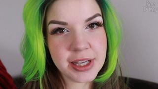 Dental Aligners: Tray 2 MKV