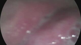 Did you see that?? Endoscope view!! 1