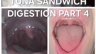 Bailey: Tuna Sandwich Digestion Part 4