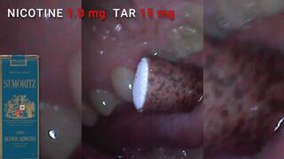 Smoking St Moritz menthol 120s inside