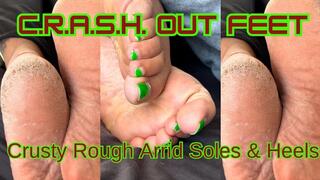 C R A S H Out Feet | Crusty Rough Arrid Soles & Heels | POV Dry Foot Worship