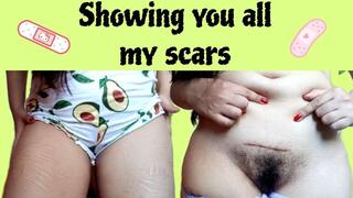 Showing you all my scars