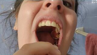 Exploring My Cavities in Extreme Close-Up - Deep Mouth View