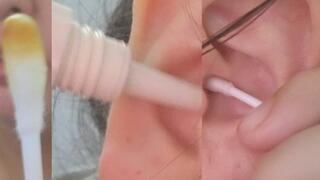 Close-Up Earwax Removal with Q-Tips – Intimate Ear Cleaning Session part 2
