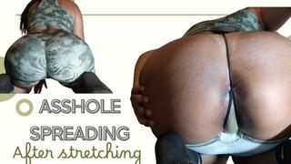 Asshole winking after stretching