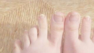 I haven't cut my toenails in 3 months! Ingrown toenail