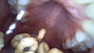 KatieGulps: New Endoscope Mouth Footage