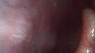 Katja: New Endoscope Mouth Tour