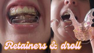 Retainers and Endless Drooling