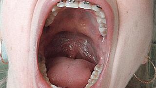 Wide mouth! MP4