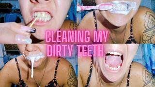 Cleaning my dirty teeth