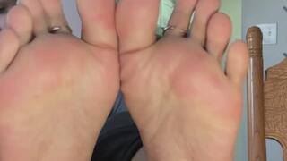 After Gym Sock Removal