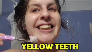 Cleaning my dirty teeth at the morning