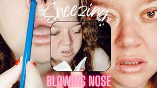 Molly blows her nose, snot, sneezes and allergies