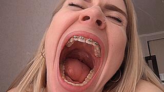 Huge mouth! MP4