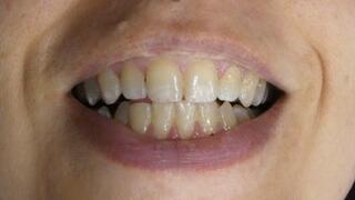 Greasy Chicken Thighs Get Chewed ASMR Sloppy Eating Burping