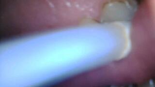 Smoking Mercedes 100s inside