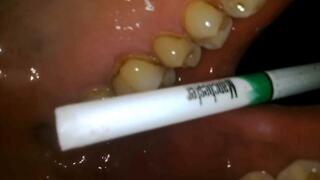 Smoking Manchester Menthol superslims 100s inside