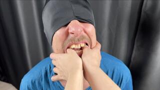 Man Hard Biting Stepmommy Fingers Extreme Close Ups - Macro video Marks on Fingers, Crooked Teeth, Vampire Fangs 4K