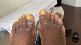 Sexy wrinkled patterned feet - slow motion foot tease